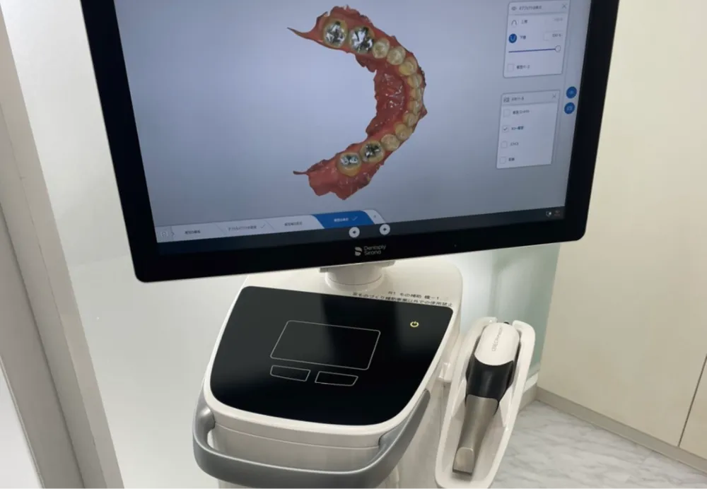 プライムスキャン（IOS口腔内スキャナー）