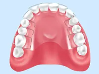 床タイプの装置